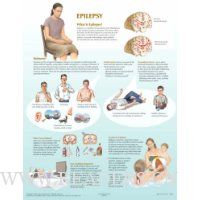  Epilepsy Chart