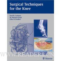  Surgical Techniques for the Knee