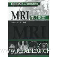  MRIƬָ