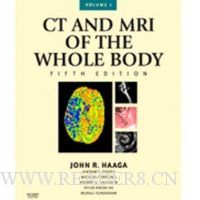  CT and MRI of the Whole Body, 2-Volume Set