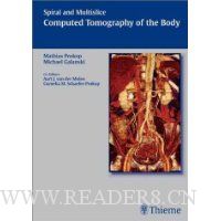  Spiral and Multislice Computed Tomography of the Body