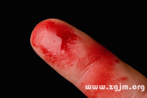 梦见手出血是什么意思