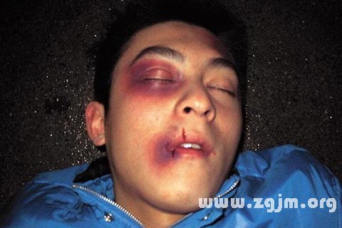 梦见被打是什么意思